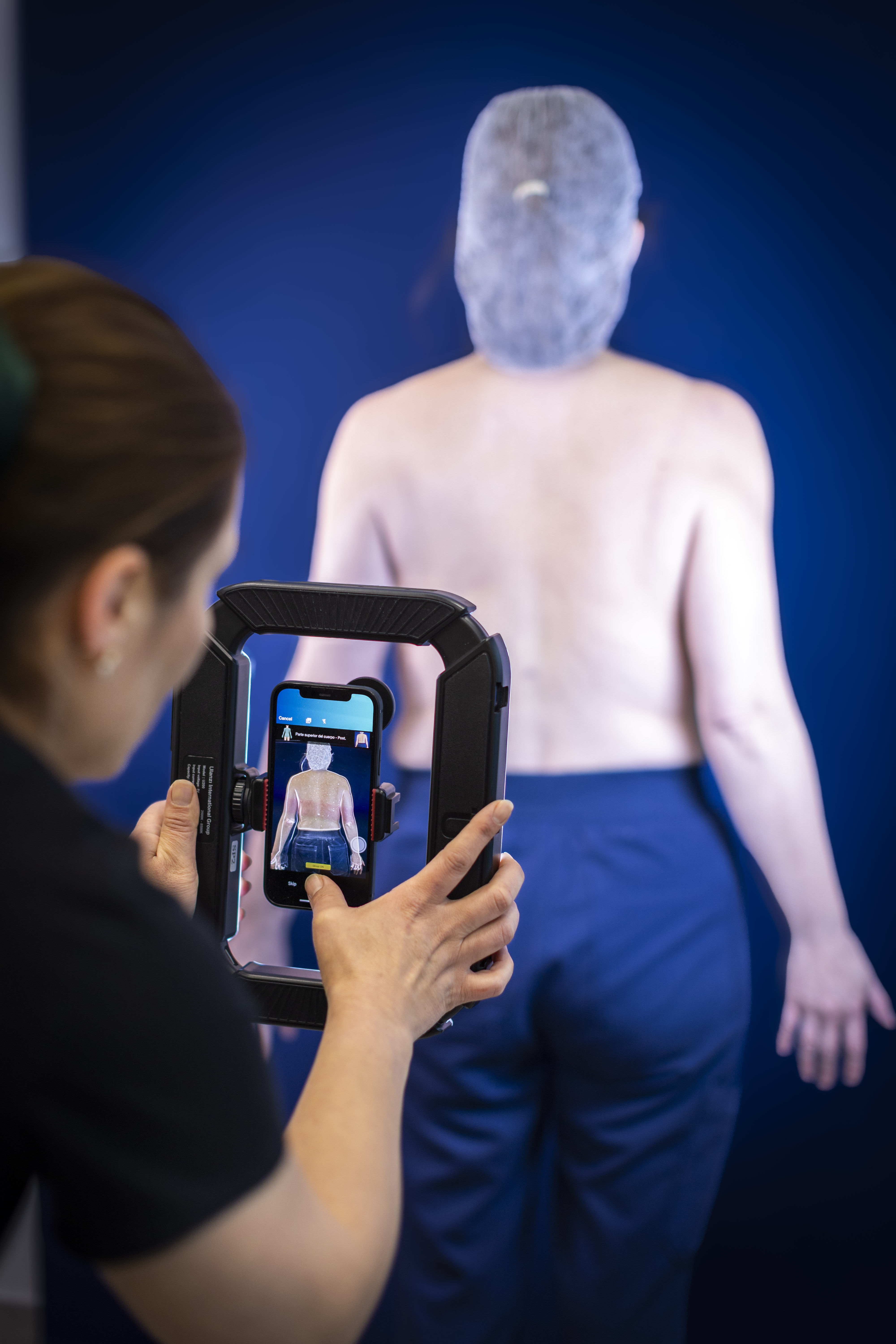 Mapeo corporal con dispositivo digital en DermaKlinic
